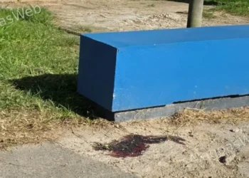 Jovem perde controle de moto e sofre acidente grave em São Miguel dos Campos