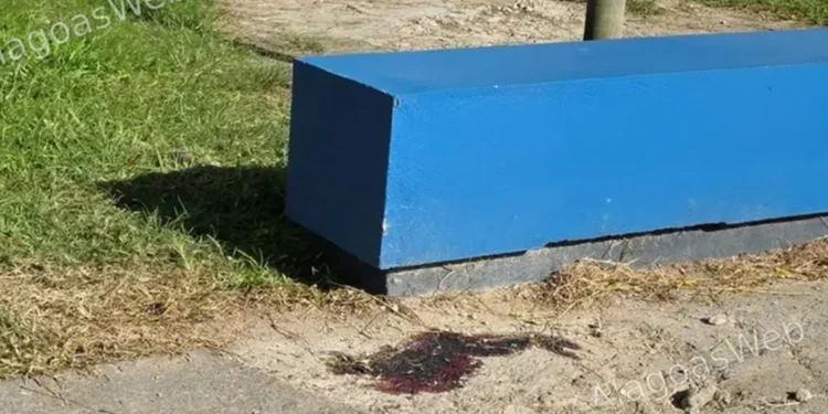 Jovem perde controle de moto e sofre acidente grave em São Miguel dos Campos